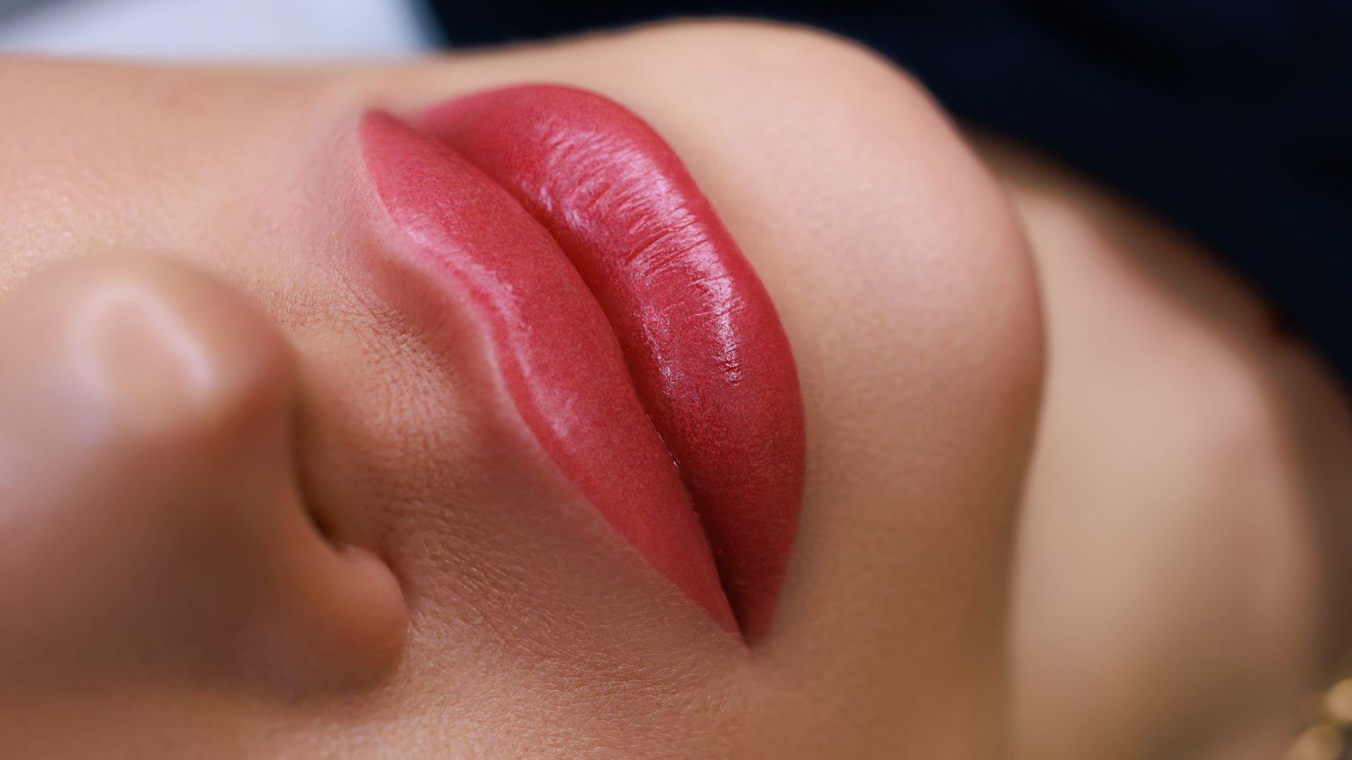 O que você precisa saber sobre o rejuvenescimento labial com laser