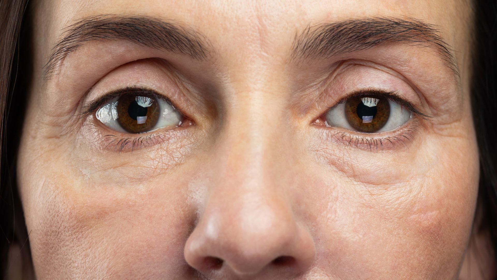 Exossomos: O Rejuvenescimento e Crescimento Capilar
