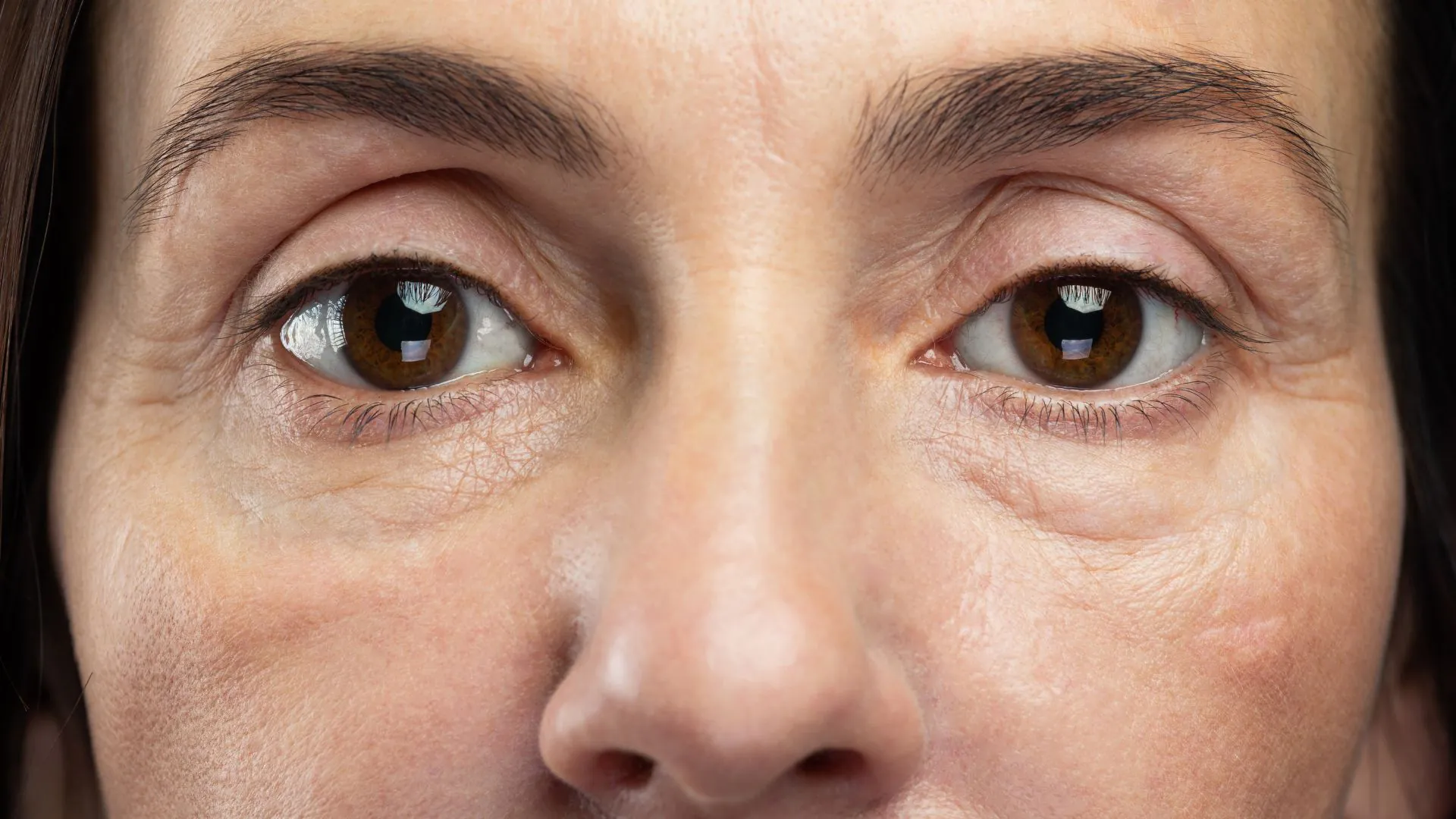 Exossomos: O Rejuvenescimento e Crescimento Capilar